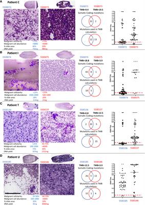 Discrepancies in tumor mutation burden reporting from sequential endobronchial ultrasound transbronchial needle aspiration samples within single lymph node stations - brief report